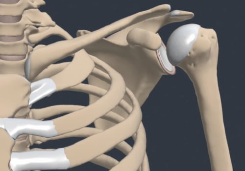 Understanding Torn Muscles: A Guide to Orthopedic Injuries and Treatment